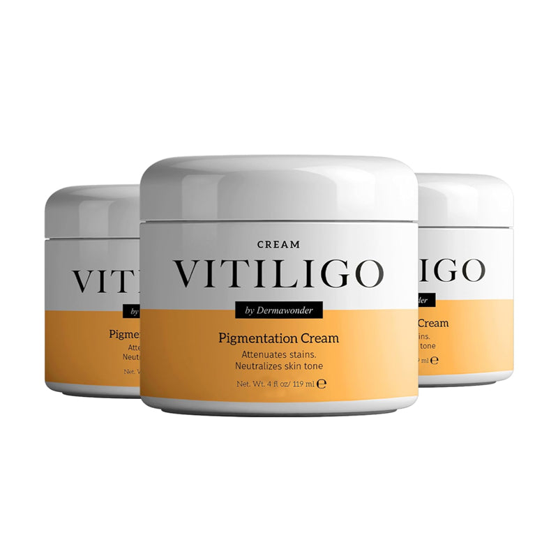 Vitiligo Dermawonder
