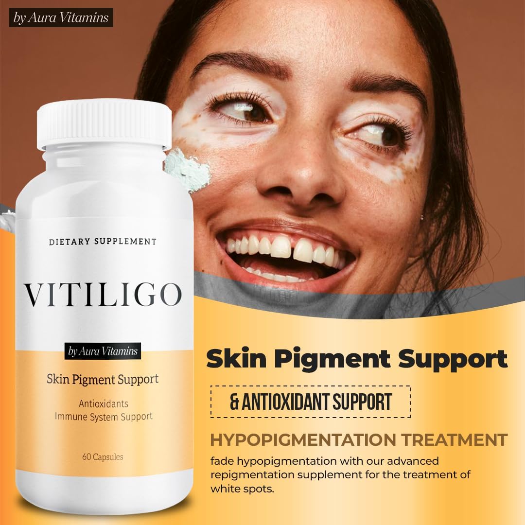 Dermawonder Vitiligo Capsules 60 Count