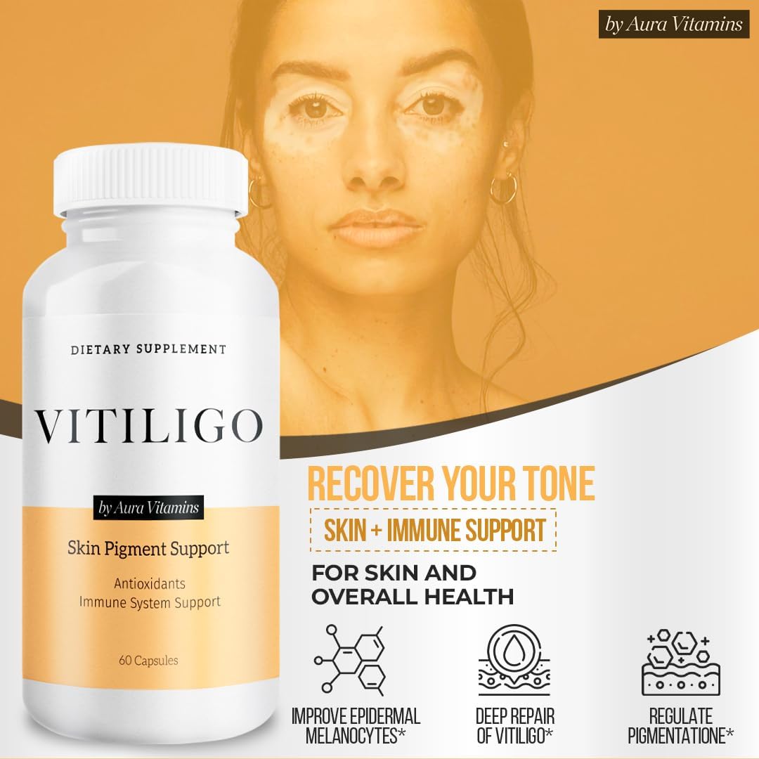 Dermawonder Vitiligo Capsules 60 Count