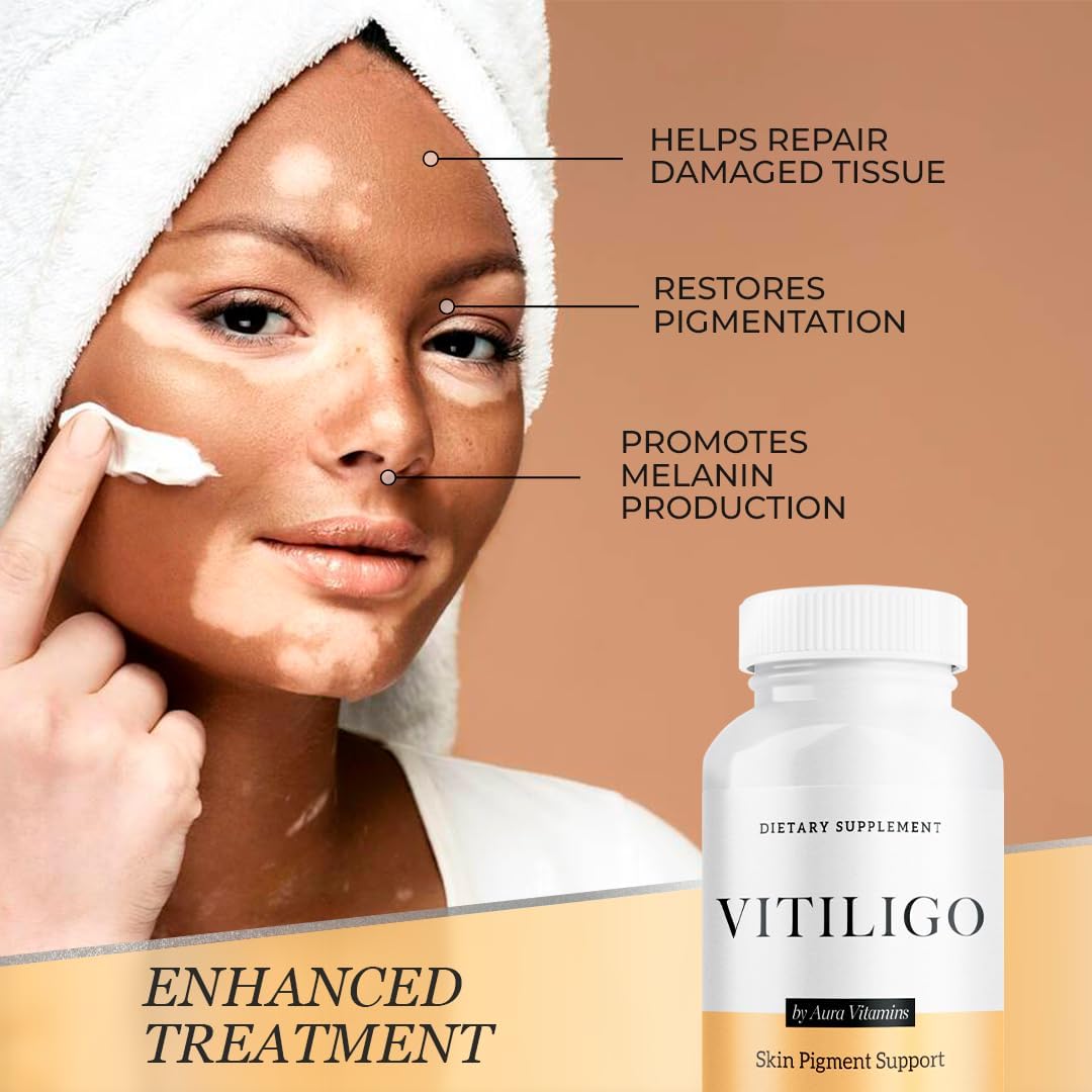 Dermawonder Vitiligo Capsules 60 Count
