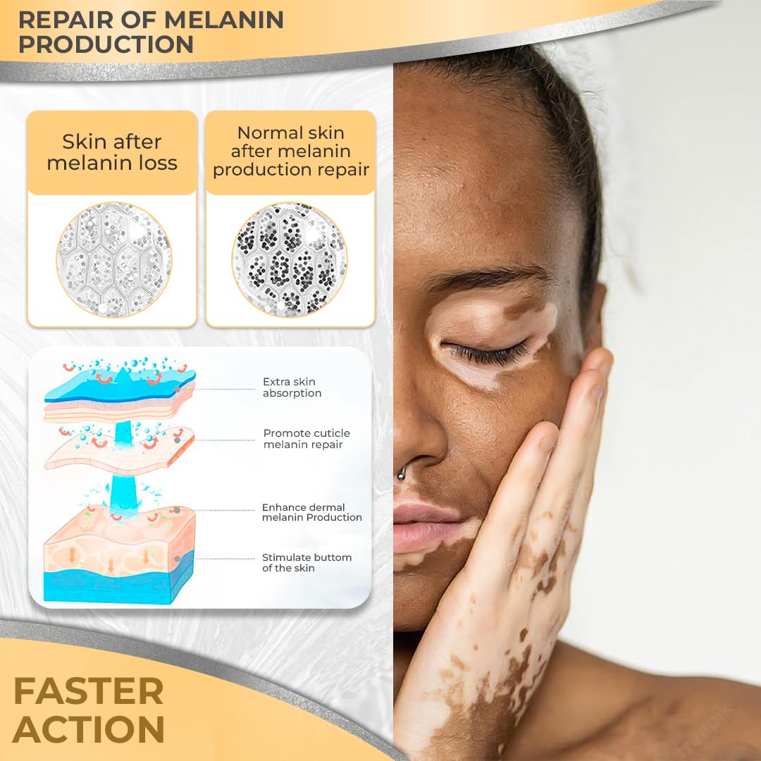 Dermawonder Vitiligo Supplement & Pigmentation Cream Set