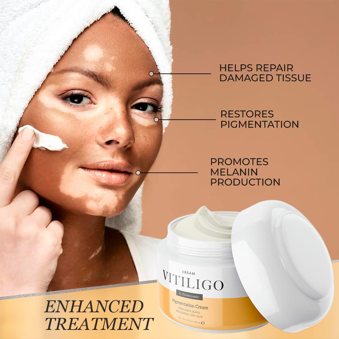 Vitiligo Dermawonder