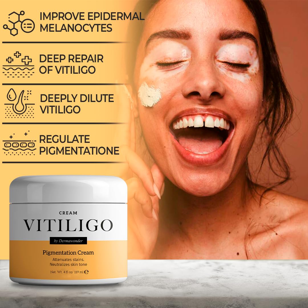 Vitiligo Dermawonder