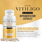 Vitiligo Capsules | Melanin & Skin Health Support
