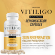 Vitiligo Capsules | Melanin & Skin Health Support