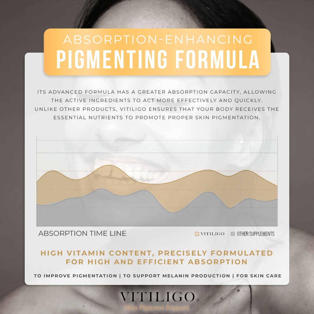 Vitiligo Dermawonder | Skin Pigmentation & Tone Support Cream