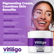 Vitiligo Cream | Advanced Skin Tone & Pigment Support