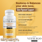 Vitiligo Capsules | Melanin & Skin Health Support