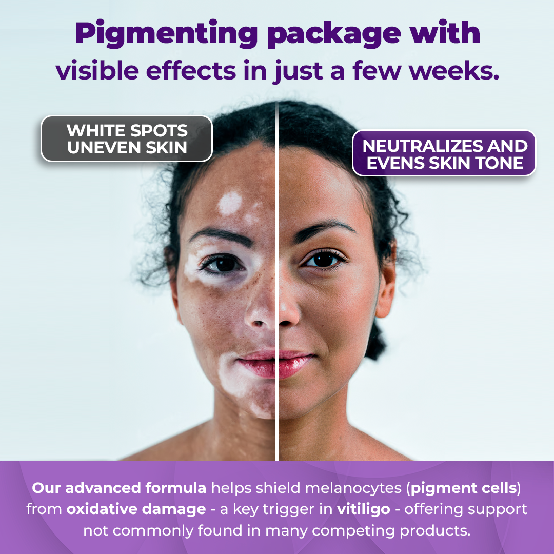 Skin Pigmentation Support Bundle | Capsules & Cream System