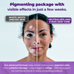 Skin Pigmentation Support Bundle | Capsules & Cream System