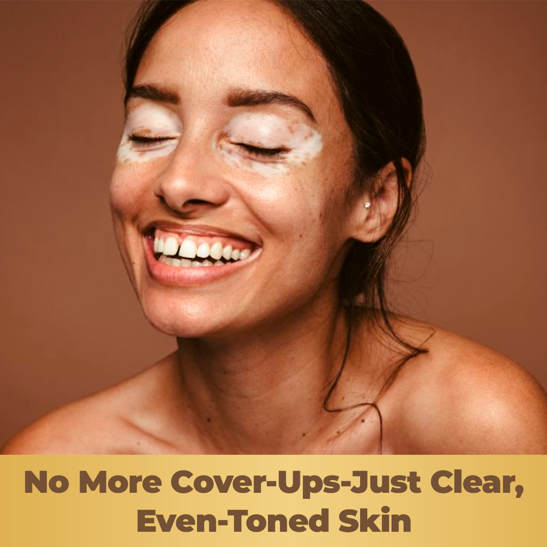 Vitiligo Capsules | Melanin & Skin Health Support