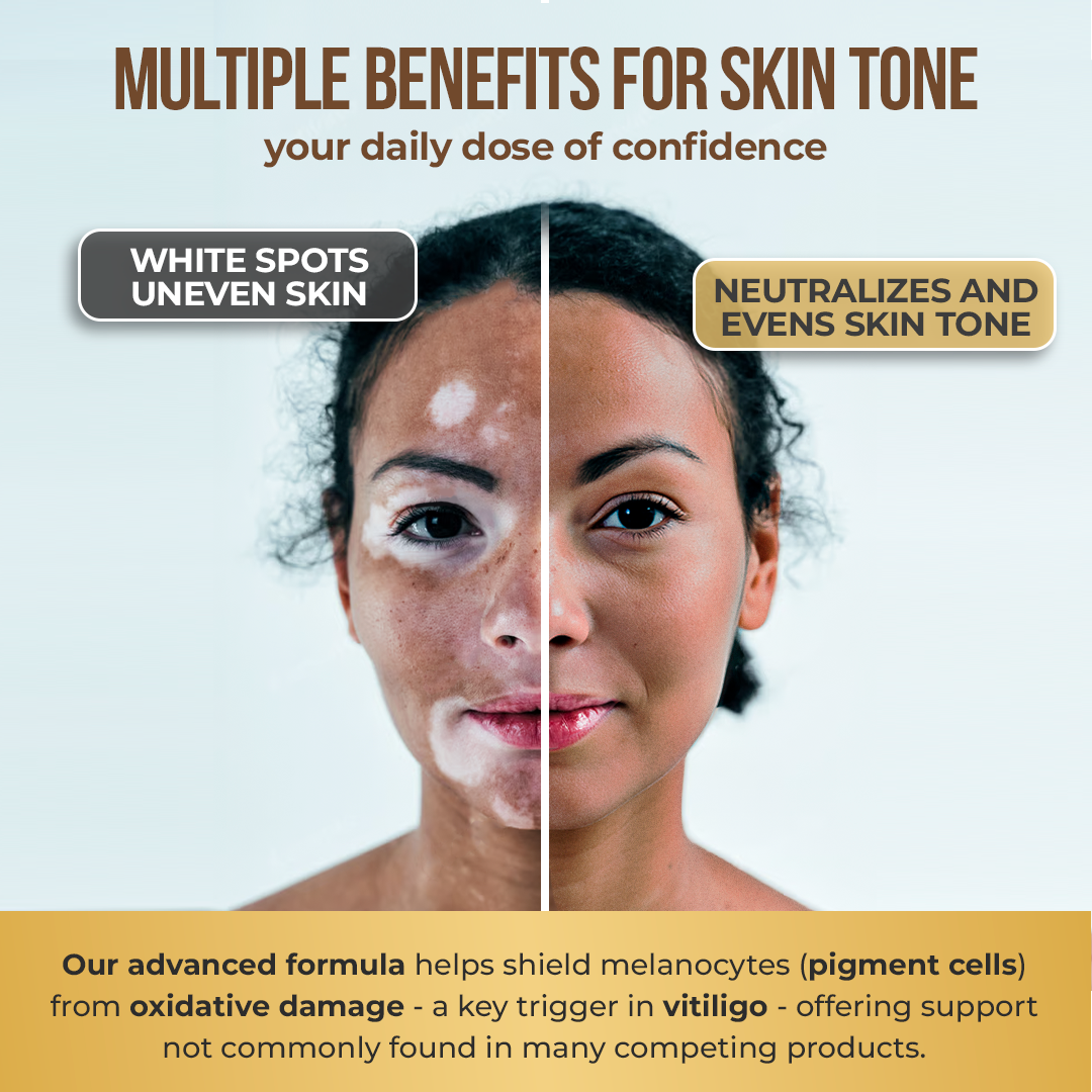 Vitiligo Capsules | Melanin & Skin Health Support