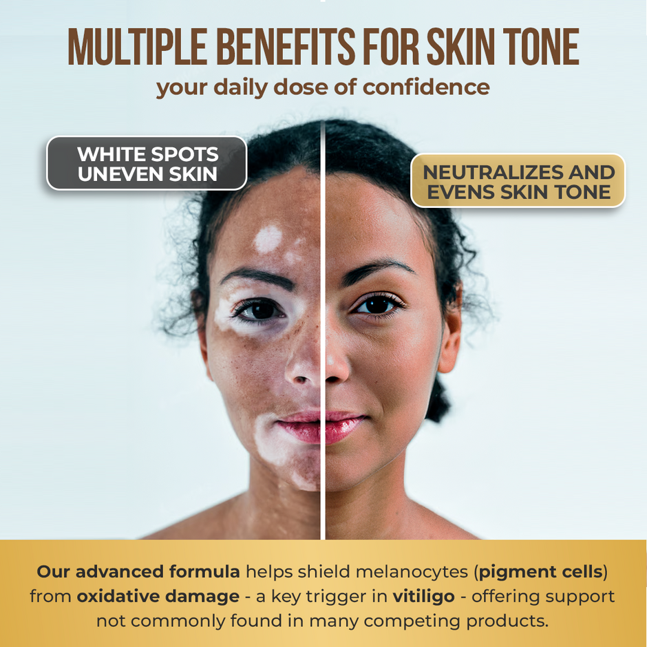 Vitiligo Capsules | Melanin & Skin Health Support