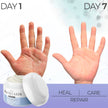 DermaWonder Psoriasis Cream | Intensive Skin Moisturizing Formula