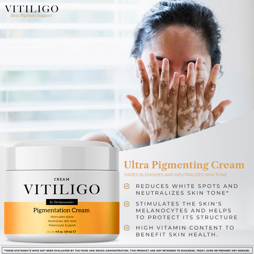 Vitiligo Dermawonder | Skin Pigmentation & Tone Support Cream