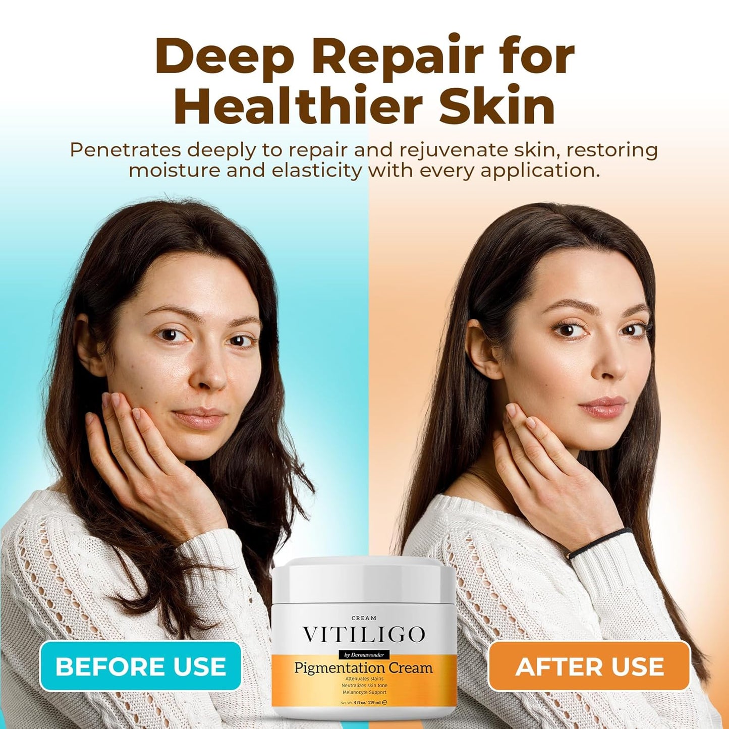 Vitiligo Capsules + Vitiligo Cream Bundle | Skin Pigmentation Support System