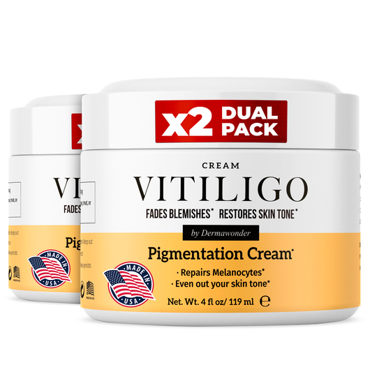Vitiligo Dermawonder